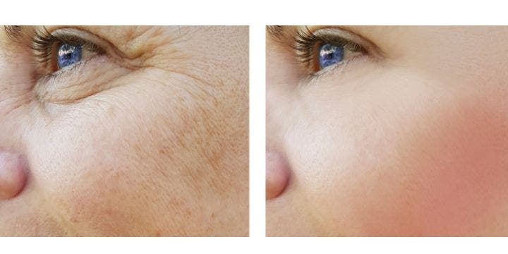 comparison between mature skin and young skin